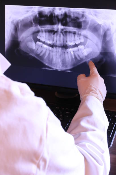 Best Emergency Gum Treatment in Millers Creek, NC